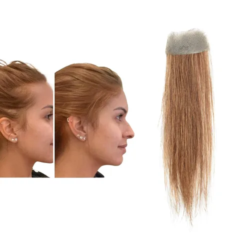 Miniatura 23 de Reemplazo de cabello humano con cicatrices, quemaduras accidentales sin vello para hombres y mujeres, pérdida de línea de cabello, cinta recta