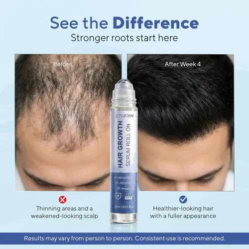 Miniatura 3 de Suero para el crecimiento del cabello en rollo en romero – 3% romero, 3% redensilo y 2% nuevamente, ayuda a apoyar la apariencia del cabello más