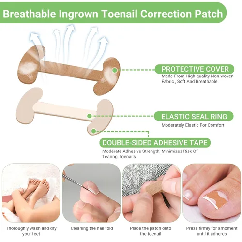 Miniatura 6 de Juego de corrector de uñas encarnadas con tiras correctoras, kit de herramientas profesionales para uñas de los pies, incluye tiras transpirables