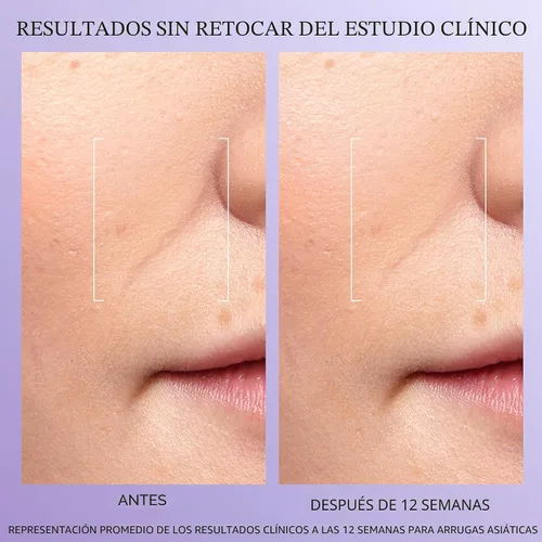 Miniatura 4 de Lancôme Rénergie H.C.F. Triple Serum - Suero de ácido hialurónico para corrección visible de signos antienvejecimiento y manchas oscuras - Con