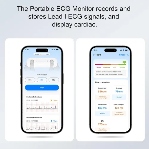 Miniatura 4 de Monitor portátil de ECG Registre y almacene señales de ECG de una sola derivación Monitorear y mostrar la frecuencia cardíaca para uso