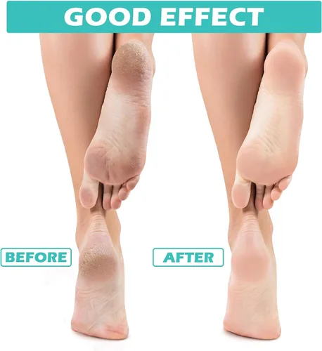 Miniatura 4 de Tarpop 3 pares de calcetines de aloe para mujer, calcetines de spa hidratantes para el día de San Valentín, para pies secos y agrietados, gel