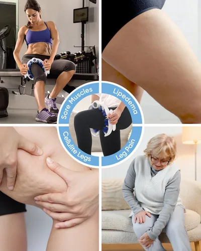 Miniatura 7 de ONUEMP Herramienta de Masaje para Celulitis, Removedor de Celulitis con Drenaje Linfático para Piernas, Rodillo Muscular para Masaje de Fascia