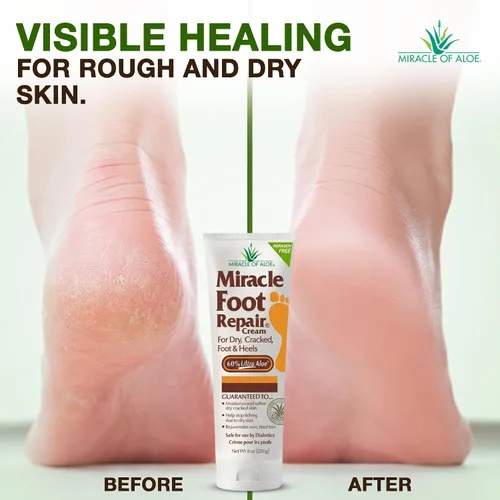 Miniatura 5 de Miracle Foot Repair Cream, (1 onza/3 unidades) repara talones y pies secos agrietados, 60% ultraaloe puro hidrata, suaviza y repara