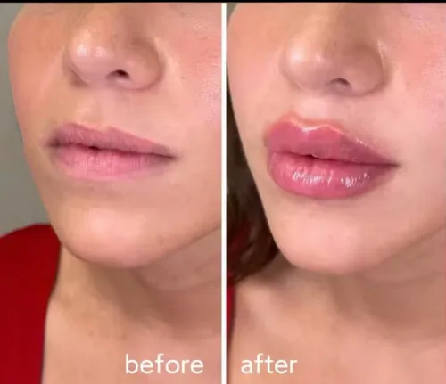 Miniatura 5 de Extreme Lip Plumping Lipgloss, Bold Volumizing Máxima Fuerza y Hormigueo Instantáneo, con colágeno, ácido hialurónico y vitamina E para labios