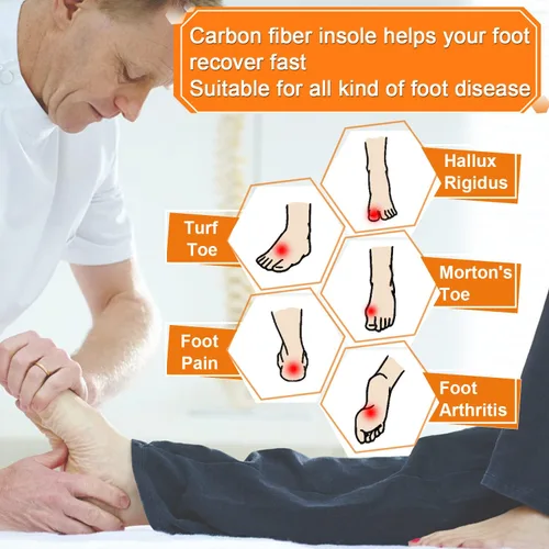 Miniatura 3 de Plantillas de fibra de carbono, 1 par de plantillas rígidas para aliviar el dolor, recuperación de la puntera de césped artrítico, Hallux rigidus