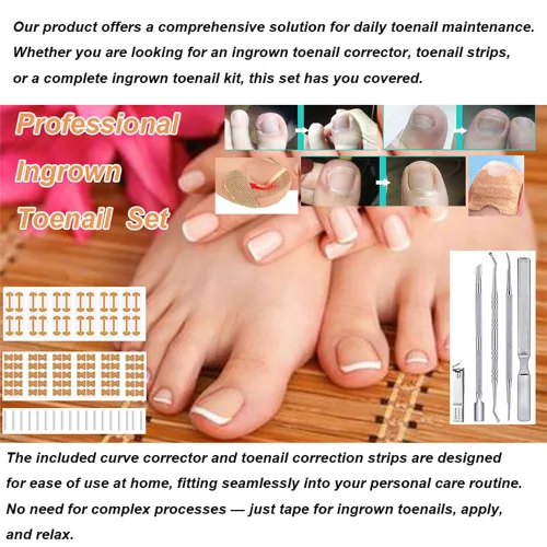 Miniatura 2 de Tratamiento de uñas encarnadas, juego profesional de herramientas de pedicura de uñas encarnadas, 60 piezas de parche corrector de uñas