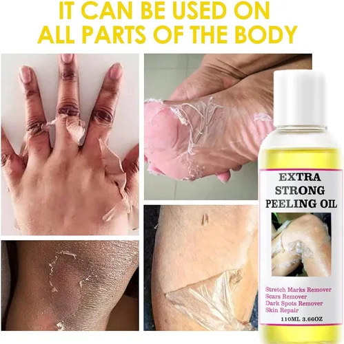 Miniatura 2 de Aceite de pelado amarillo, aceite de pelado fuerte para piel oscura, extra fuerte, solución exfoliante para el cuerpo, todo tipo de piel, removedor