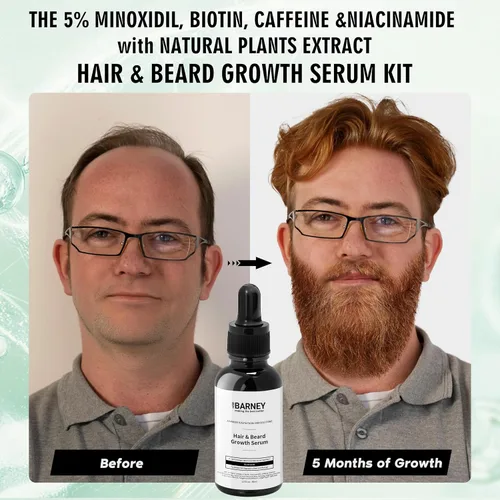 Miniatura 3 de Suero para el crecimiento del cabello y la barba de minoxidil al 5 %, extractos naturales, biotina y cafeína, promueve un crecimiento más fuerte