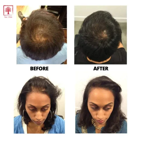 Miniatura 5 de Champú Volume Plus Fórmula antiadelgazante y voluminizadora Fabricado en Estados Unidos Sin sulfatos y parabenos Todo tipo de cabello, 8