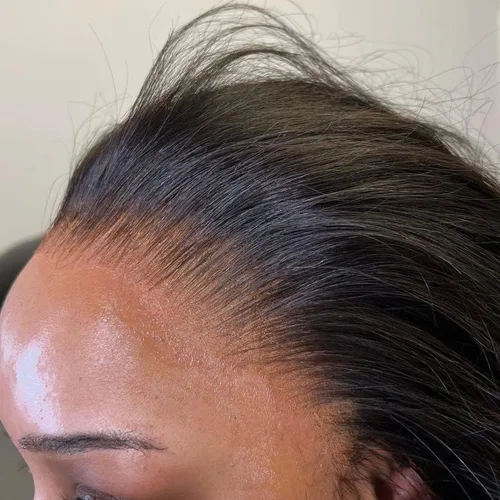 Encaje frontal HD real de 13 x 4 pulgadas, ultra fino, encaje suizo HD, nudos blanqueados, cierre frontal, cabello humano virgen prearrancado con
