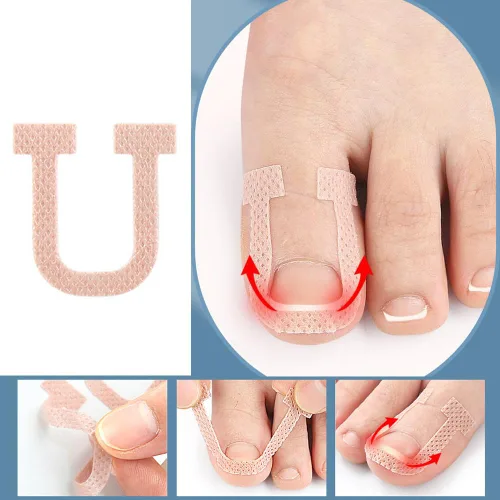 Miniatura 3 de Paquete de 40 parches correctores de uñas encarnadas en forma de U, correctoras de uñas de los pies, parches de corrección, vendajes para alivio