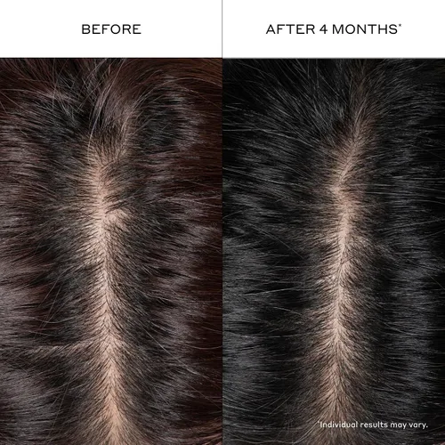 Miniatura 7 de Zenagen Suero engrosante para el cabello