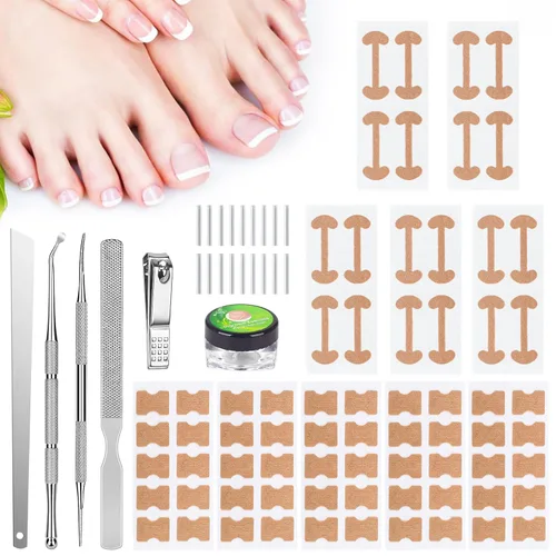 Kit de eliminación de uñas encarnadas con tiras de uñas encarnadas, parche corrector de uñas curvas, lima de uñas y herramientas de pedicura