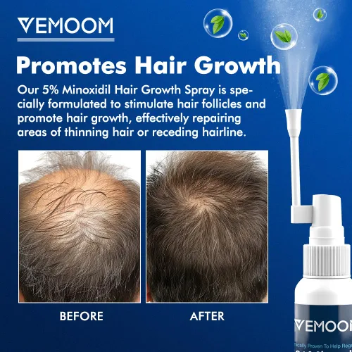 Miniatura 2 de Spray para el crecimiento del cabello de minoxidil al 5% para mujeres y hombres, tratamiento eficaz contra la pérdida de cabello para el nuevo