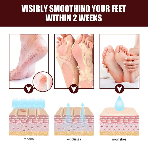 Miniatura 4 de Crema reparadora de pies de manteca de karité, ungüento curativo de la piel para talones agrietados y pies secos Crema exfoliante para masaje de 1