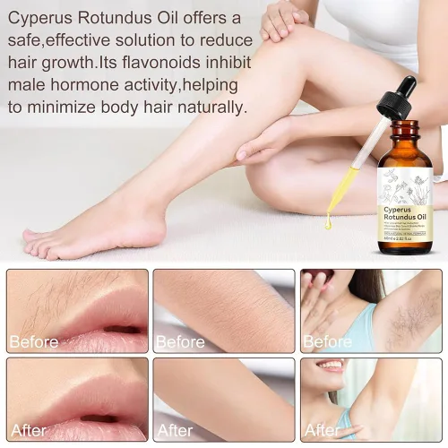 Miniatura 2 de Aceite de ciprés para depilación, reduce el crecimiento no deseado del cabello, hidrata y calma la piel, reduce el crecimiento del vello corporal
