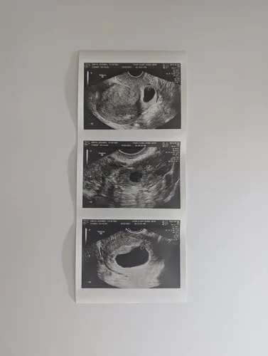 Miniatura 2 de Broma 2D personalizada tira de ultrasonido falso de 3 fotos