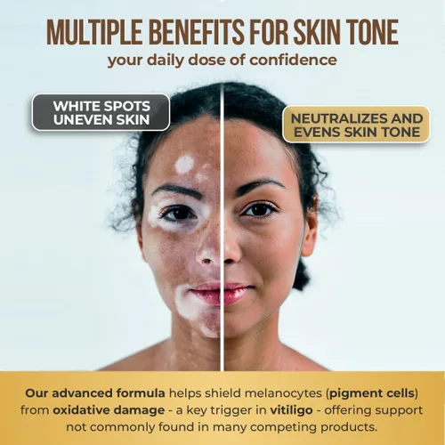 Miniatura 6 de Dermawonder - Cápsulas de vitiligo (60 unidades) Suplemento eficaz de vitíligo, reduce las manchas blancas y mejora el apoyo de la pigmentación