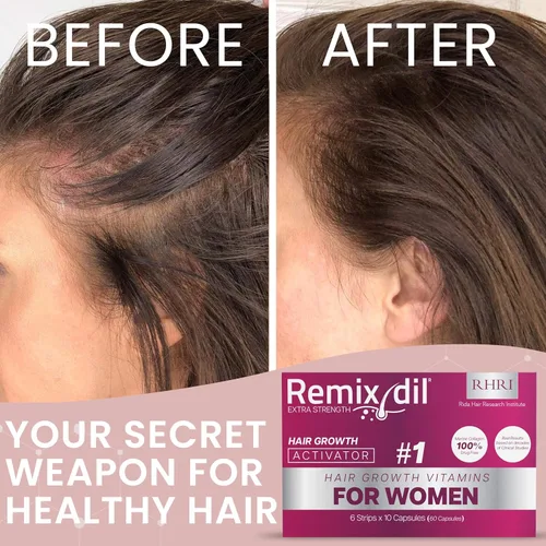 Miniatura 6 de Vitaminas para el Crecimiento del Cabello Suplementos para el Crecimiento del Cabello para Mujeres Apoya el Grosor y la Fuerza Ayuda a Reducir