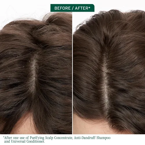 Miniatura 2 de Biolage Scalp Sync Anti-Dandruff Shampoo & Universal Conditioner Set - Targets Dandruff, Controls The Appearance of Flakes & Relieves Scalp