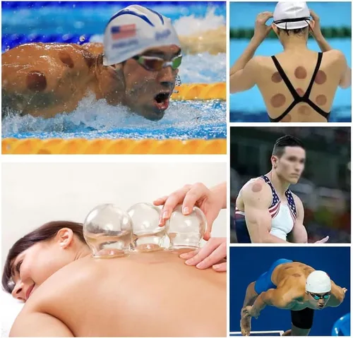 Miniatura 8 de Juegos de terapia de ventosas, 14 ventosas gruesas de vidrio de acupuntura china para profesionales, para masajear la espalda y aliviar la fatiga