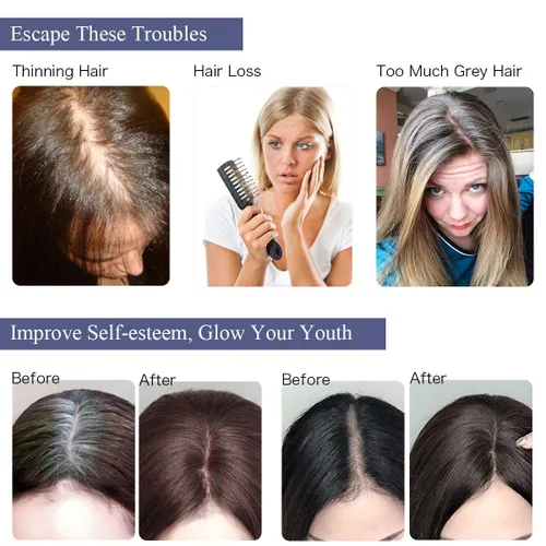 Miniatura 6 de Toppers de cabello humano con clip, sin costuras, para mujer, base de encaje para cabello picante, 12 pulgadas, rubio decolorado