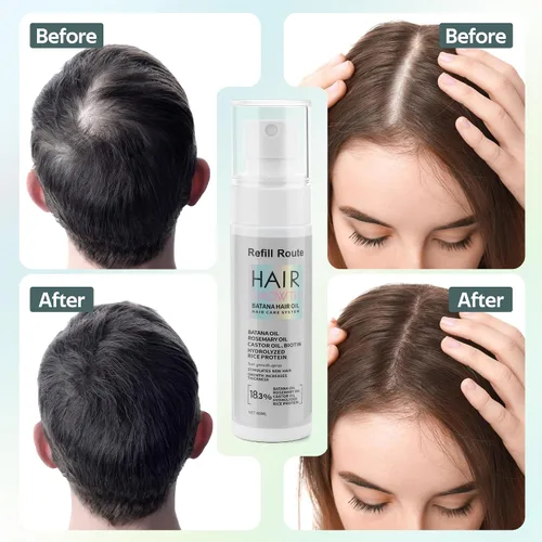 Miniatura 3 de Aceite de batana para el crecimiento del cabello, aceite de batana natural crudo para el crecimiento del cabello para mujeres/hombres con agua