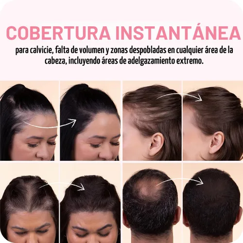 Miniatura 5 de BOLDIFY Polvo de línea del cabello (GRANDE, 10g) - Color de cabello para retoque de raíces para cobertura de canas - Polvo para el cabello que Negro