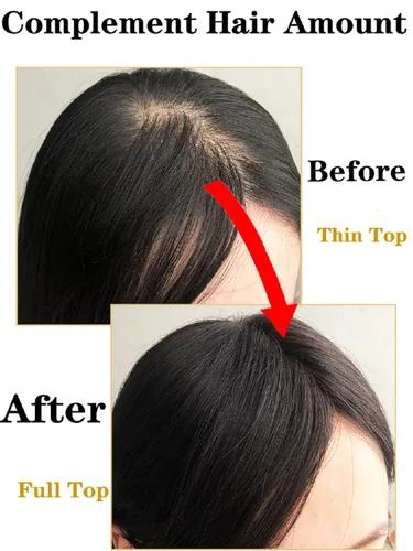 Miniatura 9 de Toppers de cabello humano real de 2.8x3.9 in para mujer, clips finos en encaje suizo para cubrir cabello calvo o blanco, 10 pulgadas