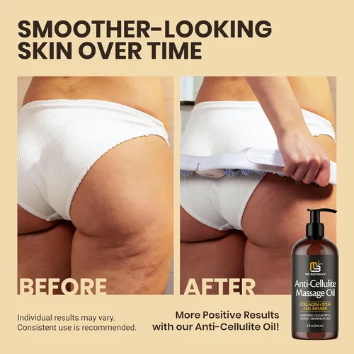 Miniatura 6 de M3 Naturals Rodillo anticelulítico y masajeador de drenaje linfático Fascia Blaster para piel contorneada y más suave Herramienta para dolores