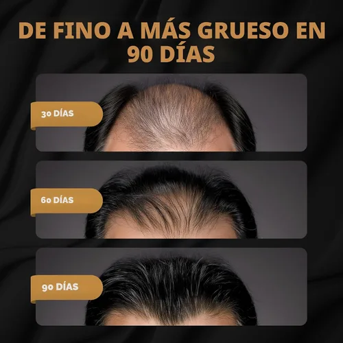 Miniatura 2 de SPARTAN™ Acondicionador Activador de Raíces para Hombre - Acondicionador para el Crecimiento del Cabello, Hidratante para Cabello Grueso