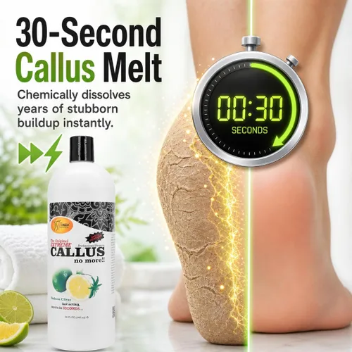 Miniatura 2 de SPA REDI - Gel removedor de callos para pies - Cuidado profesional de pies de pedicura - Elimina los callos más duros en segundos y suaviza los Lima