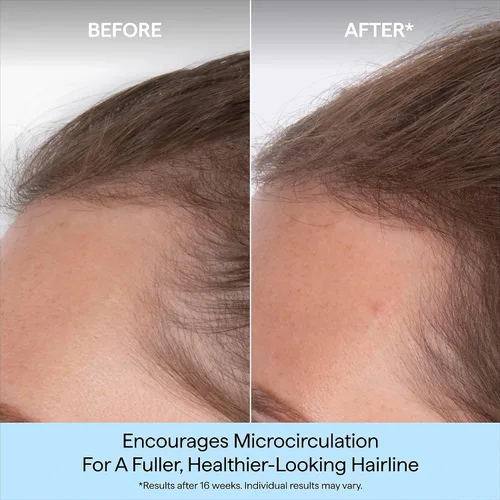 Miniatura 2 de Briogeo Destinado a la densidad de cafeína + suero de densidad de péptidos de biotina Aumenta el grosor y el volumen del cabello para cabello fino