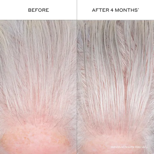 Miniatura 8 de Zenagen Suero engrosante para el cabello