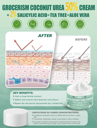 Miniatura 6 de Grocerism Crema de urea 50 por ciento para pies con coco 5.29 onzas Crema para pies y manos de máxima fuerza con 2% de ácido salicílico, árbol