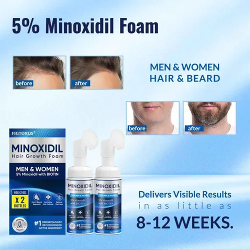 Miniatura 4 de Espuma de minoxidil al 5%, espuma de minoxidil para hombres, minoxidil para el crecimiento del cabello de mujeres, minoxidil para hombres y mujeres