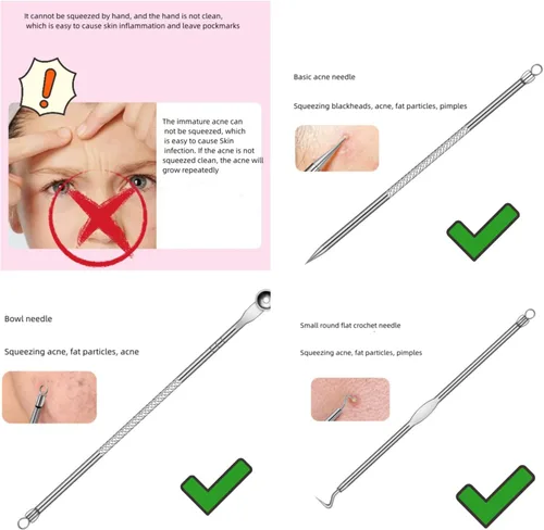 Miniatura 4 de Pinzas faciales profesionales para puntos negros, kit extractor de acné, herramienta para reventar espinillas, clip para espinillas, clip para acné