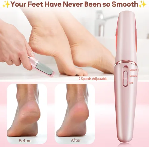 Miniatura 9 de Removedor de Callos para Pies, ZABOUL Removedor de Callos Eléctrico para Pies Recargable Herramientas de Pedicura Varita de Pedicura Suave Lima
