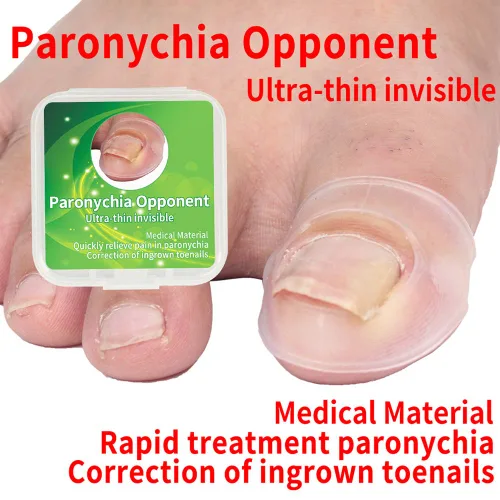 Miniatura 2 de Corrector de uñas encarnadas, 2 piezas de herramienta de corrección de uñas encarnadas de silicona, corrector de uñas encarnadas, tratamiento