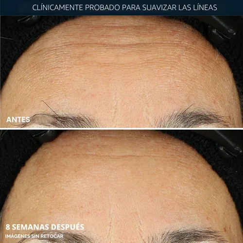 Miniatura 5 de RoC Retinol Correxion Suero de Noche Anti-Envejecimiento contra Arrugas, Suero de Retinol para el Rostro, Tratamiento Diario para Líneas Finas