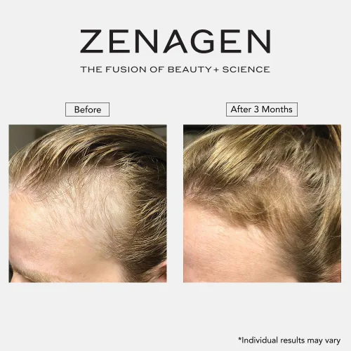 Miniatura 11 de ZENAGEN Revolve Champú Espesante para Mujeres Apoya la Apariencia de Cabello Más Abundante y de Aspecto Más Saludable, Desarrollado para Cabello