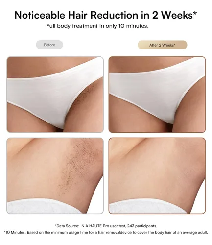 Miniatura 2 de INIA Depilación Láser con Cuidado de Enfriamiento con Hielo para Mujeres y Hombres, HAUTE Pro Removedor de Vello IPL Sin Dolor en Casa para Vello