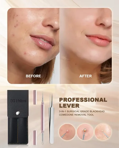 Miniatura 4 de Herramienta Profesional de Eliminación de Milia Facial y Extractor de Puntos Blancos, Juego de Aguja de Doble Punta de Aleación de Titanio y Pinzas