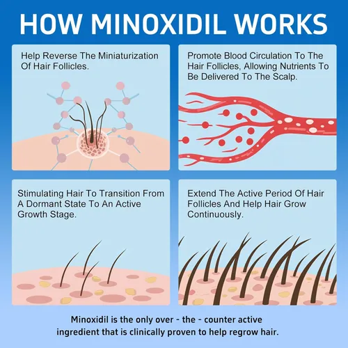 Miniatura 7 de Paquete de 6 minoxidil al 5% con biotina, tratamiento para el crecimiento del cabello, minoxidil para el crecimiento del cabello y la barba