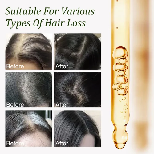 Miniatura 4 de Aceite de batana para el crecimiento del cabello, 100% puro, aceite natural para el crecimiento del cabello, nutre el cuero cabelludo, elimina