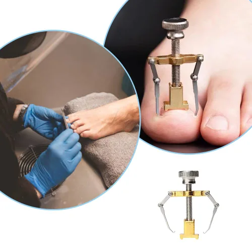 Miniatura 3 de Corrector de uñas encarnadas profesional encarnadas levantador de uñas encarnadas práctica abrazadera para el tratamiento de uñas encarnadas