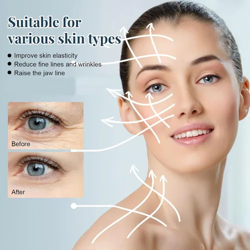 Miniatura 6 de Hilos de proteína soluble coreana, hilos de proteína para el cuidado facial en el hogar, hilo de colágeno soluble para rutina de cuidado de la piel