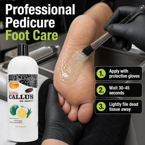 Miniatura 4 de SPA REDI - Gel removedor de callos para pies - Cuidado profesional de pies de pedicura - Elimina los callos más duros en segundos y suaviza los Lima