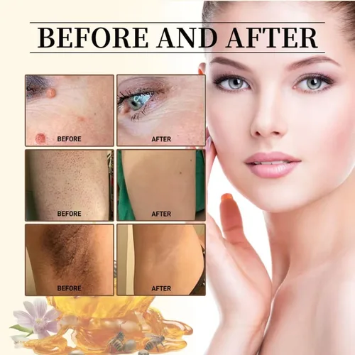 Miniatura 6 de Bee Venom Cream, nueva crema reparadora de tratamiento de la piel para todas las partes del cuerpo, gel de miel suave profesional para todo